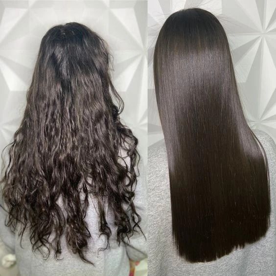 Antes e depois Karseell - imagem 2